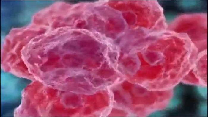 rettic maxresdefault